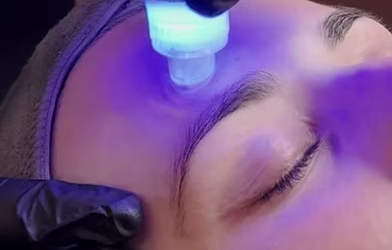 Anti Ageing Treatments for Wrinkles, Skin Laxity & Collagen Loss